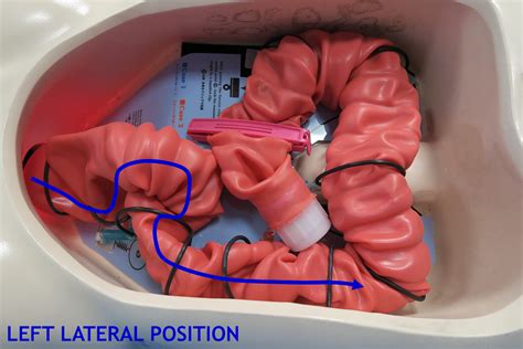 Image result for Colonoscopy Positioning