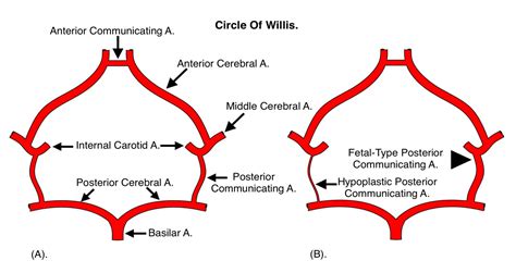 Posterior Communicating Artery