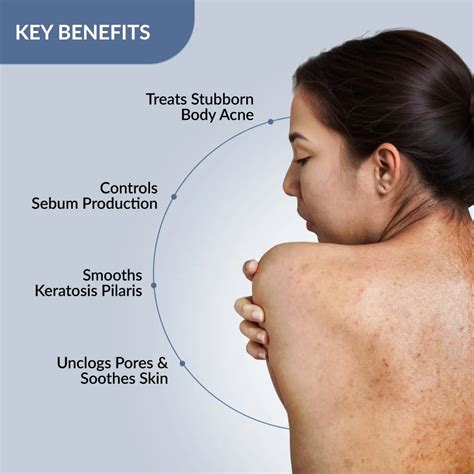 Fixderma Body Spray to reduce Body and Back Acne from – Fixderma Skincare