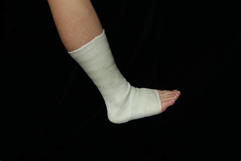 Fiberglass Cast For Broken Foot at Dylan Belstead blog