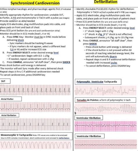 Image result for What Does Synchronized Cardioversion Do