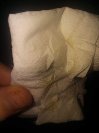 Sticky/Stretchy White Discharge 13 DPO *TMI PICS* | BabyCenter