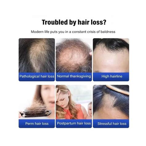 Aultink Horse Oil Nourishing Shampoo-No.1 Japan, India | Ubuy