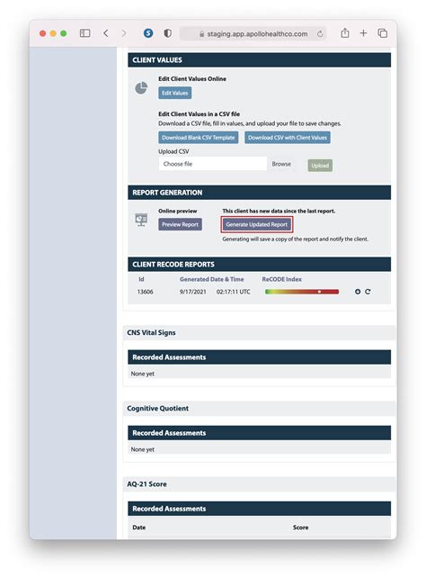 Image result for Recode and Pre-Code Apollo