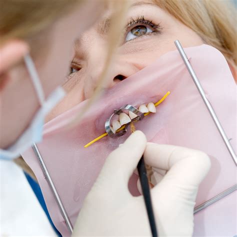 Rubber Dental Dams: What They Are and Why Dentists Use Them | Oral Answers