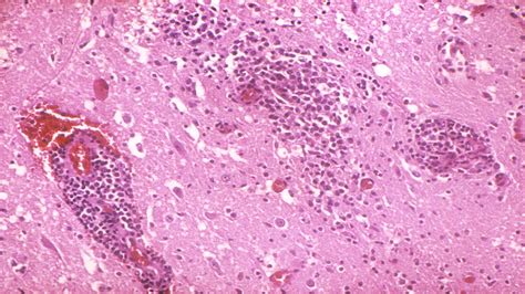 Transmission of West Nile Virus | West Nile Virus | CDC