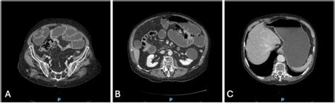 Cardiovascular Medicine | An Open Access Journal from MDPI