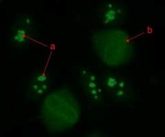 Image result for Homogeneous Pattern