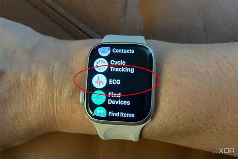 How Accurate Is The Iphone Watch Ecg at Brent Vangundy blog