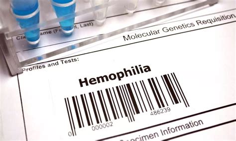 ICMR Study Finds Cheaper Emicizumab Dose Works for Haemophilia A Patients