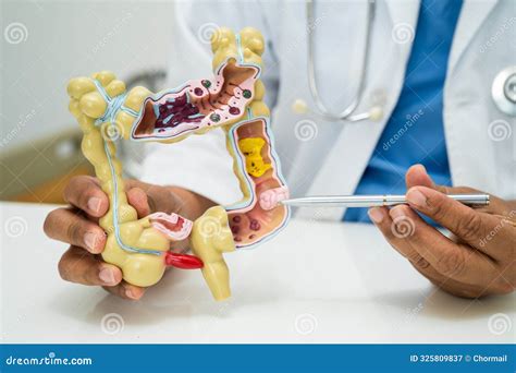 Image result for Digestive System Appendix