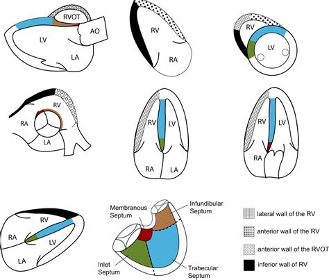 Right Ventricular Function in Cardiovascular Disease, Part I | Circulation