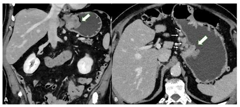 Imaging in Gastric Cancer: Current Practice and Future Perspectives