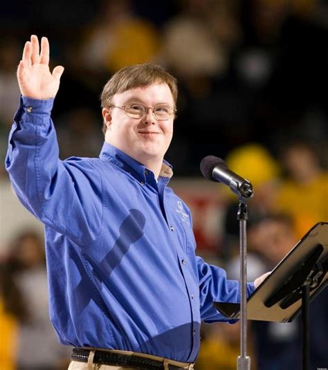 Famous Down Syndrome People