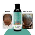 Keshpallav Hair Oil + Shakuntala Daily Use Shampoo Super Saver Combo