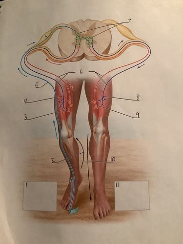 Image result for Crossed Extensor Reflex Demonstration