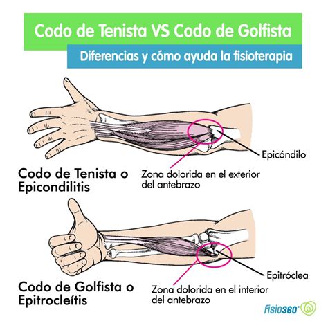 Pin en Lesiones, trastornos y enfermedades