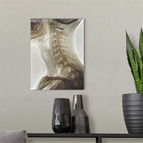 Normal neck, X-ray | Great Big Canvas