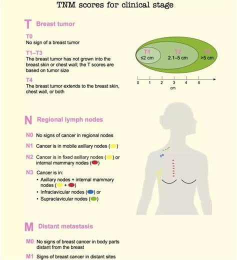 乳腺癌术后辅助化疗方案及其适应症 - 知乎