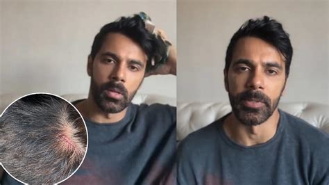 'Absolutely disheartened': TV actor Anuj Sachdeva calls out Mumbai ...