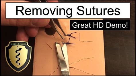 Removing Sutures Step by Step 的图像结果