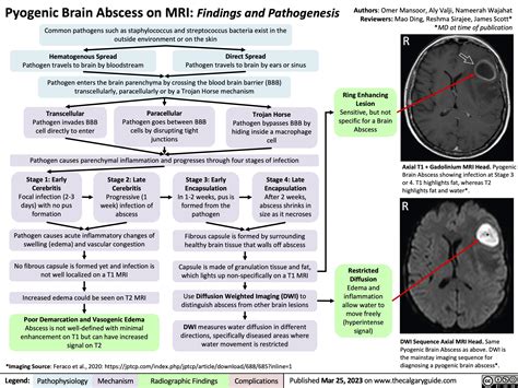 Pyogenic Brain Abscess on MRI | Calgary GuideCalgary Guide