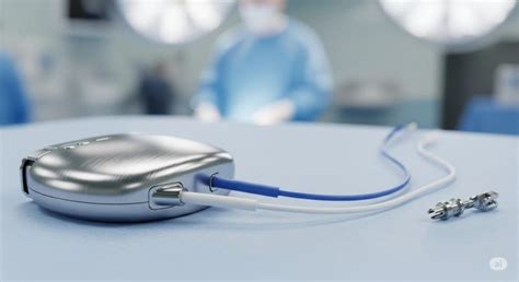 Pacemaker Market Companies Outlook 2024–2034: Size, Share, Growth ...