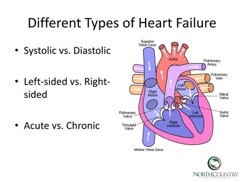 PPT - Disease Specific Care Management: Congestive Heart Failure PowerPoint Presentation - ID ...