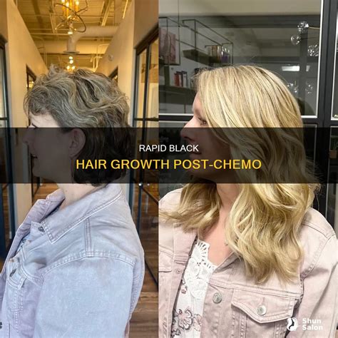 Rapid Black Hair Growth Post-Chemo | ShunSalon