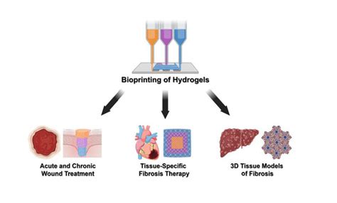 Bioprinted Hydrogels for Fibrosis and Wound Healing: Treatment and Modeling