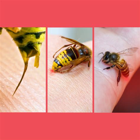 Hornet Sting