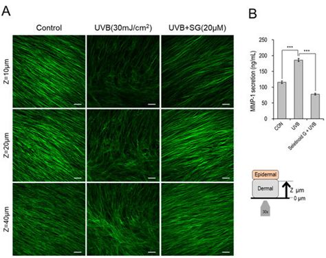 Synthetic Retinoid Seletinoid G Improves Skin Barrier Function through ...