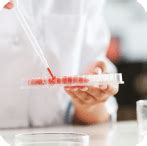 थायरॉईड समस्या शोधण्यासाठी TSH चाचणी कशी महत्त्वपूर्ण आहे?