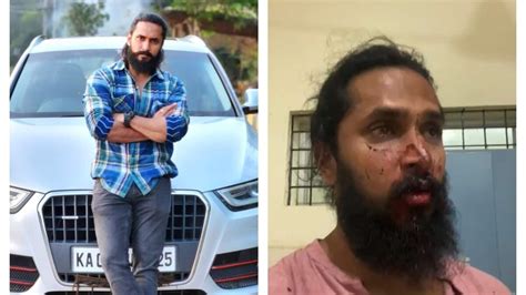 ₹1.8 lakh cash, chain robbed from Chetan Chanddrra in Bengaluru mob ...