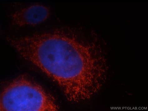 LRDD antibody (12119-1-AP) | Proteintech