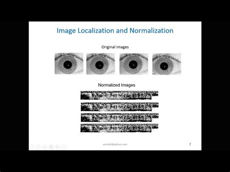 Image result for Inner Eye Deep Learning Toolkit