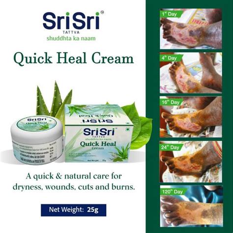 Sri Sri Tattva Quick Heal Cream Pack of 3 - Price History