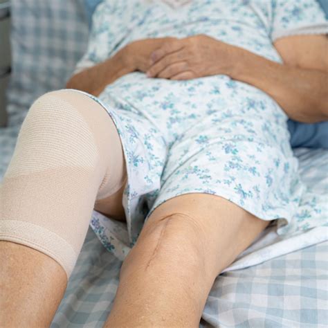 How Much Does Knee Replacement Surgery Cost?
