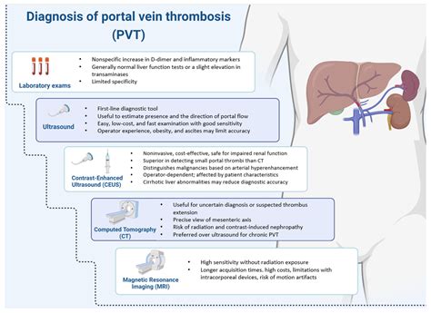 Portal Vein Thrombosis: State-of-the-Art Review
