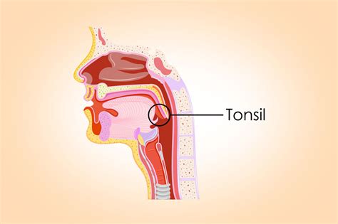 Acute Tonsillopharyngitis Icd 10 - TommyjoysRichard