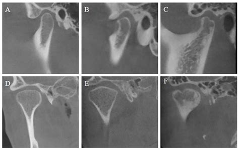 JCM | Special Issue : Clinical Updates in Oral Rehabilitation