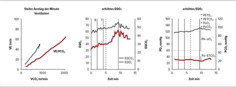 Der diagnostische Ansatz bei pulmonaler Hypertonie - Kardiologie ...