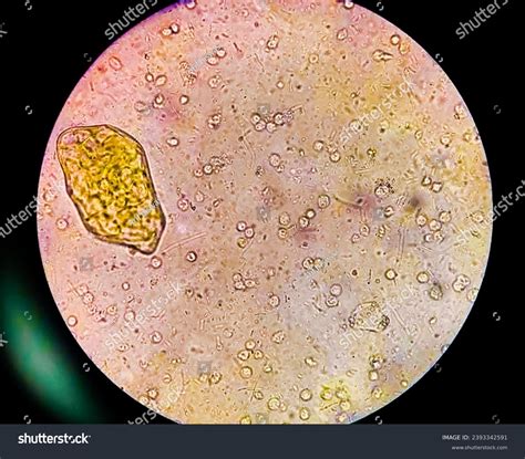Stool Specimen Microscopic Show Cysts Entamoeba Stock Photo 2393342591 | Shutterstock