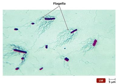 Fig. 17 . Flagella staining