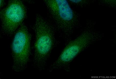 IPO11 antibody (14403-1-AP) | Proteintech