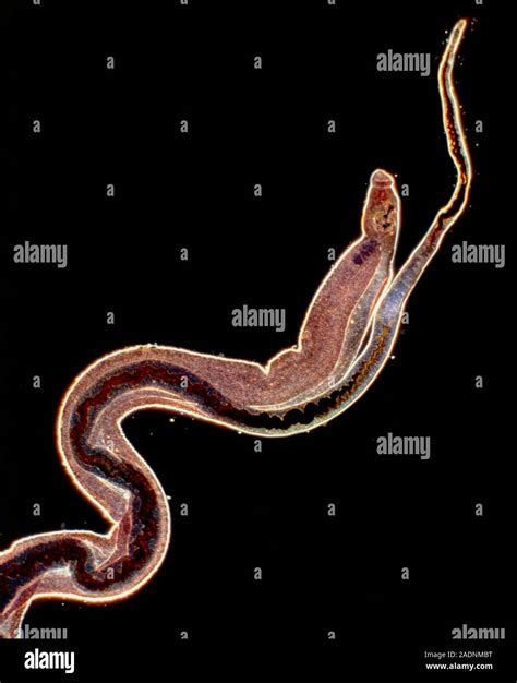 Bilharzia fluke. Light micrograph of male & female blood flukes, Schistosoma mansoni. These ...