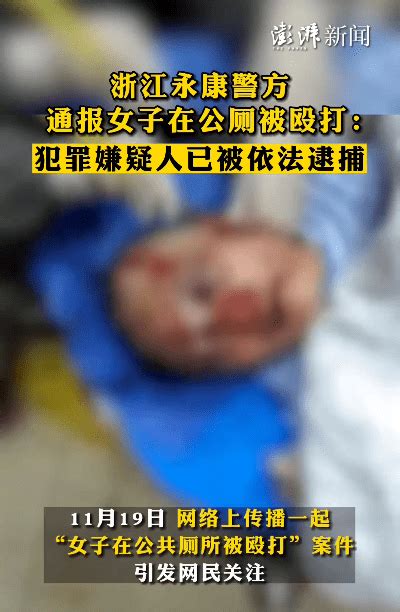 触目惊心！浙江一女子在公厕被19岁男子暴力殴打，几乎毁容_轻伤_二级_网友