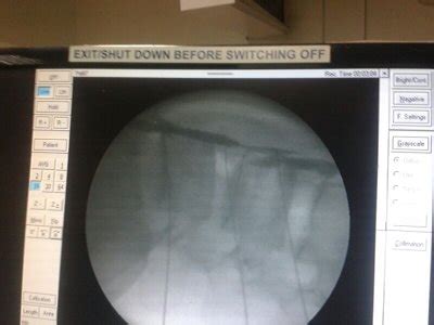 Dr. JAIDEEP SINGH,Dr. JAIDEEP SINGH bhopal, spine pain , knee pain ...