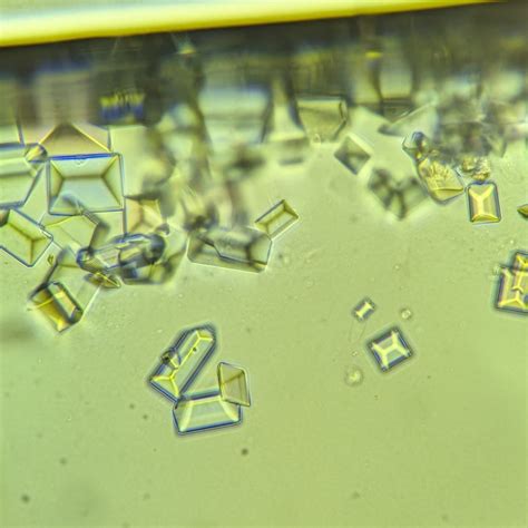 Triple Phosphate Crystals: Identification & Clinical Significance