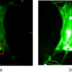 Image result for Fluoro Injection